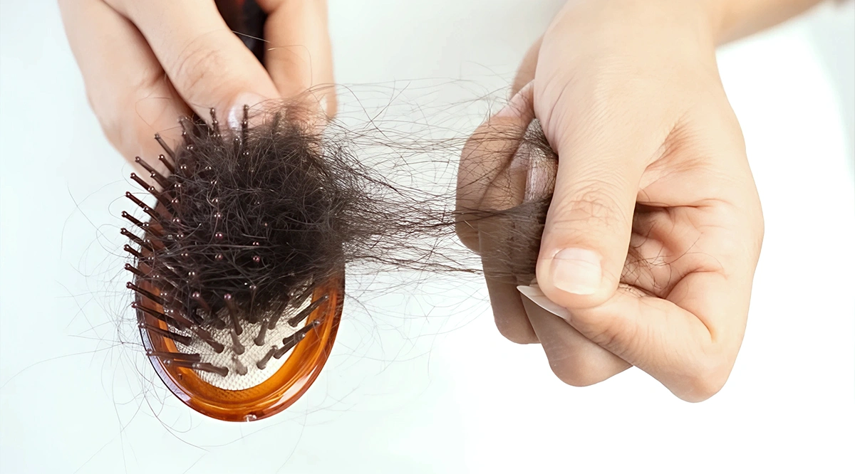 تقوية الشعر الضعيف