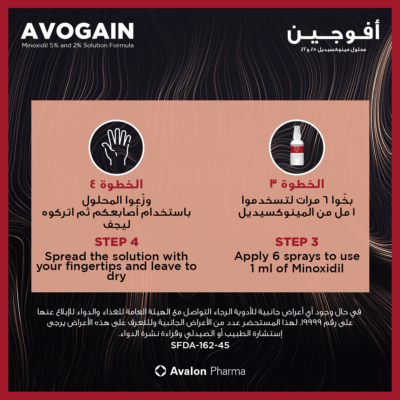 Avalon-Avogain 2% Solution 50 ml for Hair Loss Treatment