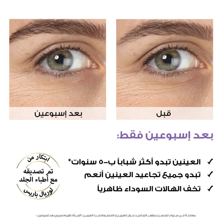 ⁦لوريال هيالورون إكسبرت سيروم العين 20 مل⁩ - الصورة ⁦3⁩