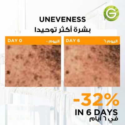 Garnier Skin Active Fast Bright 3% Vitamin C & Niacinamide Serum 1 Ampoule 1.5 ml