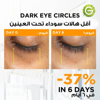 Garnier Skin Active Fast Bright 3% Vitamin C & Niacinamide Serum 1 Ampoule 1.5 ml