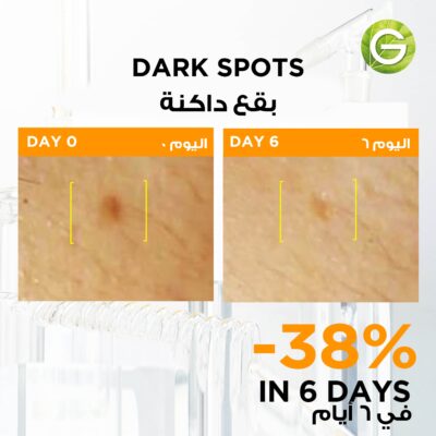 Garnier Skin Active Fast Bright 3% Vitamin C & Niacinamide Serum 1 Ampoule 1.5 ml