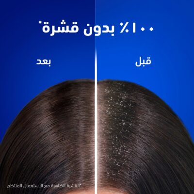 شامبو هيد آند شولدرز إنسيابي وحريري٣٩٠ مل