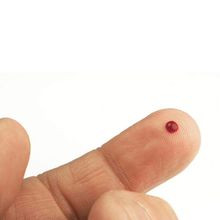 ⁦أكيوتشيك إنستانت جهاز تحليل سكر بالدم⁩ - الصورة ⁦7⁩