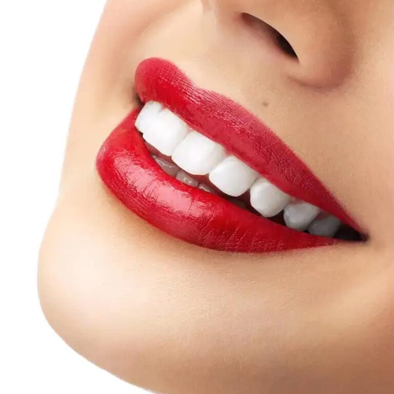 ⁦بلانكس وايت شوك معجون أسنان للتبيض 75 مل - ابتسامة مشرقة وآمنة⁩ - الصورة ⁦5⁩