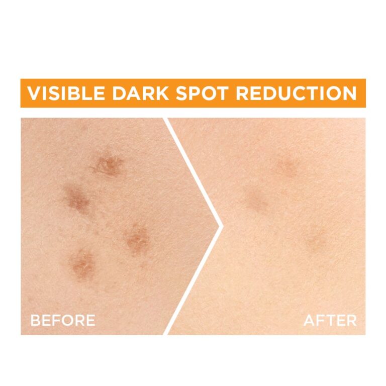Garnier Skin Active Fast Bright Vitamin C Serum 30 ml - Image 5