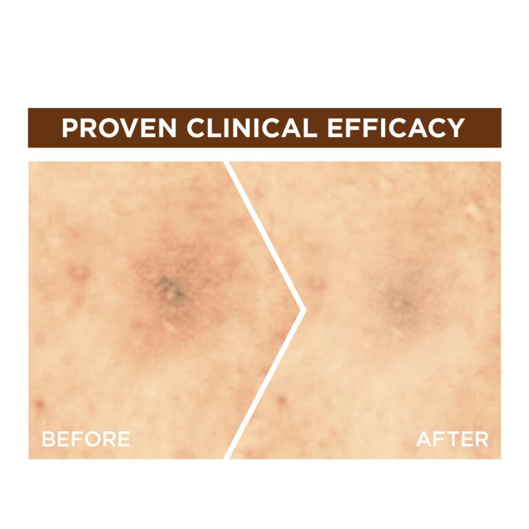 Garnier Skin Active Night Serum With Vitamin C 30 ml - Image 5
