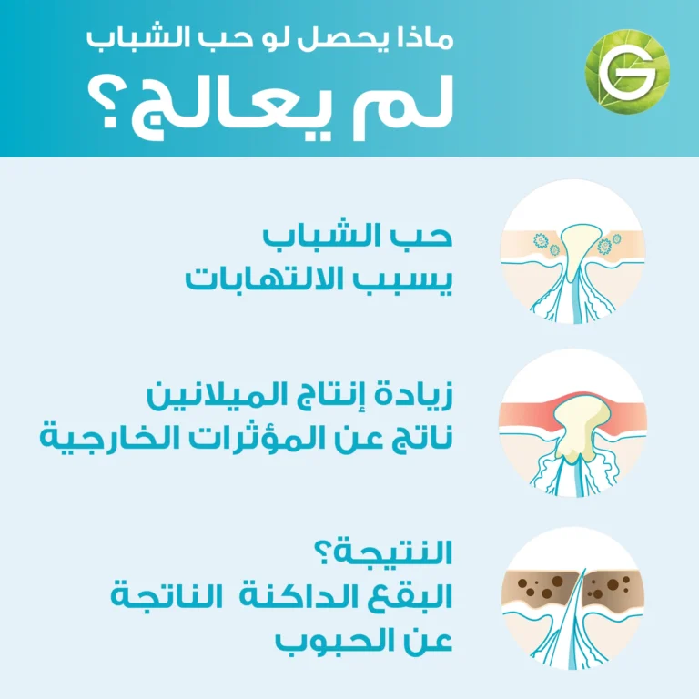 ⁦جارنيه سكين أكتيف سيروم تنقية سريعة بحمض الساليسيليك ١٥ مل⁩ - الصورة ⁦5⁩