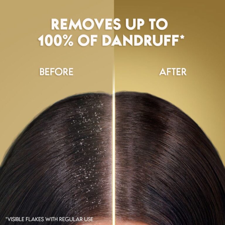 Head & Shoulders 200Ml Conditioner Rejuvenation - Image 5