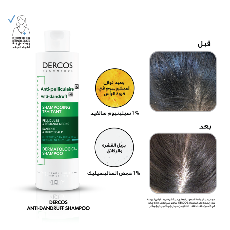 Vichy Dercos Anti Dandruff Shampoo For Dry Hair 200 ml - Image 2