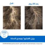 ⁦يورياج دي اس شامبو لعلاج قشرة الرأس الشديدة مع حمض اللاكتيك | خالٍ من الصابون 150 مل⁩ - الصورة ⁦4⁩
