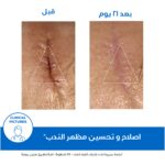 ⁦يورياج باريديرم سيكا كريم إصلاح البشرة المتضررة بالزنك والبانثينول 100مل⁩ - الصورة ⁦4⁩