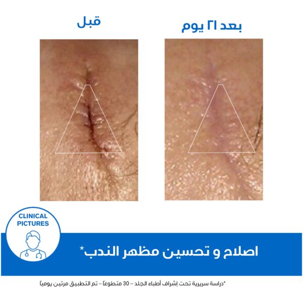 ⁦يورياج باريديرم سيكا كريم إصلاح البشرة المتضررة بالزنك والبانثينول 100مل⁩ - الصورة ⁦4⁩